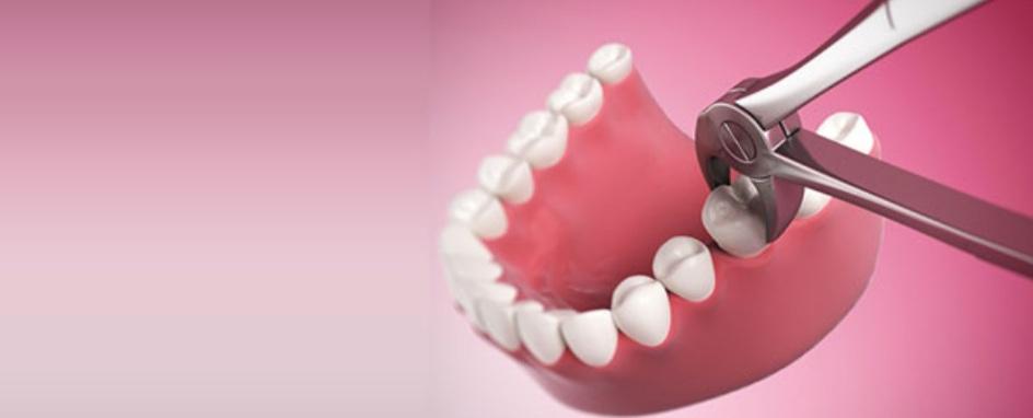 جراحی دندان