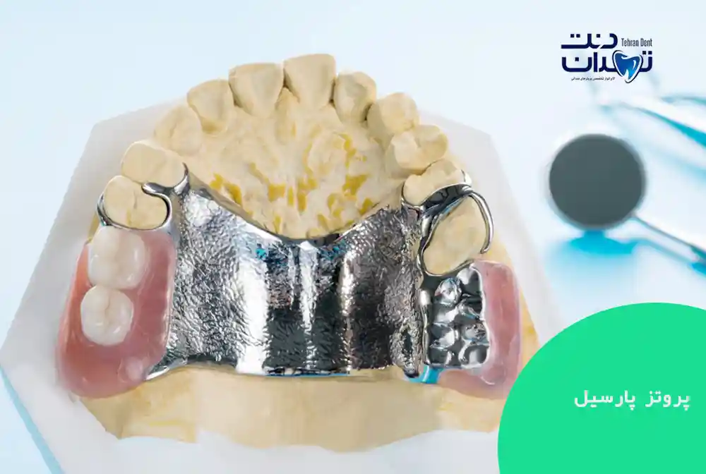 پروتز پارسیل دندان چیست