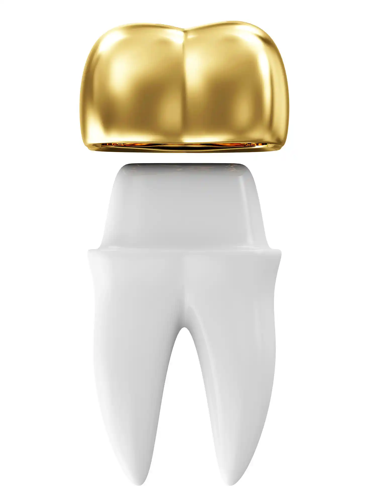 کاشت دندان طلا