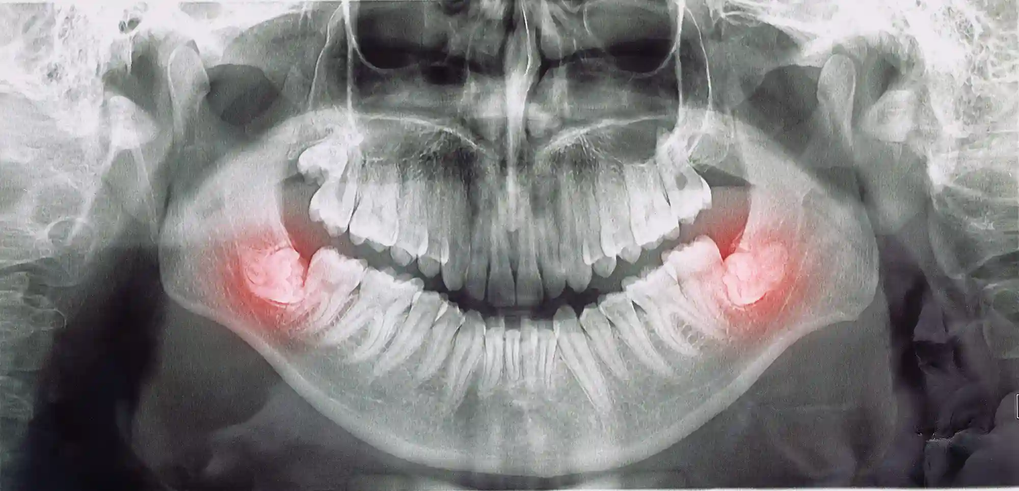 عکس دندانپزشکی
