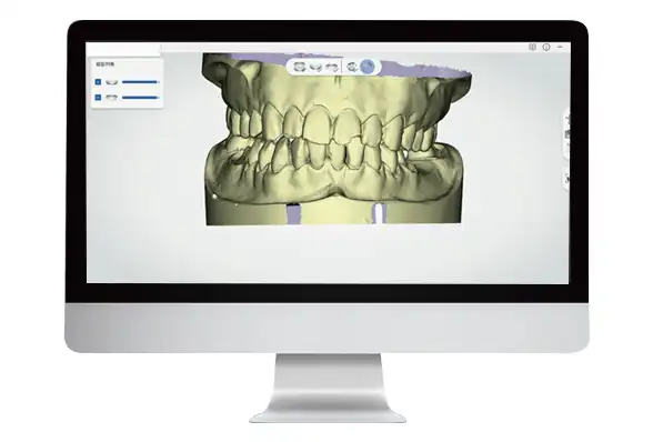 اسکنر دندانسازی سه بعدی گلوریس ال6